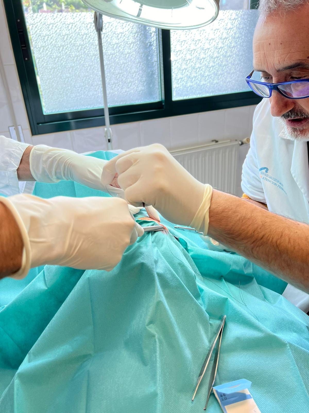 El doctor Carlos Eirea realiza una cirugía para extirpar un quiste sebáceo en el quirofanillo del centro de salud de Bueu. |