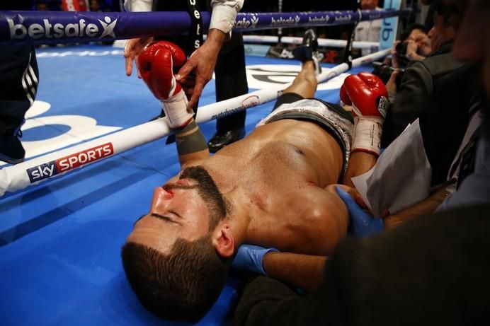 Cerefino Rodriguez after being knocked out