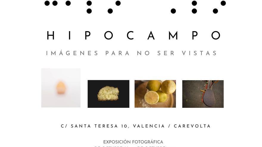 Hipocampo