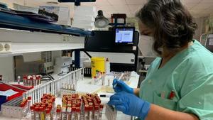 Una sanitaria, con muestras para un programa de detección precoz del VIH en Urgencias
