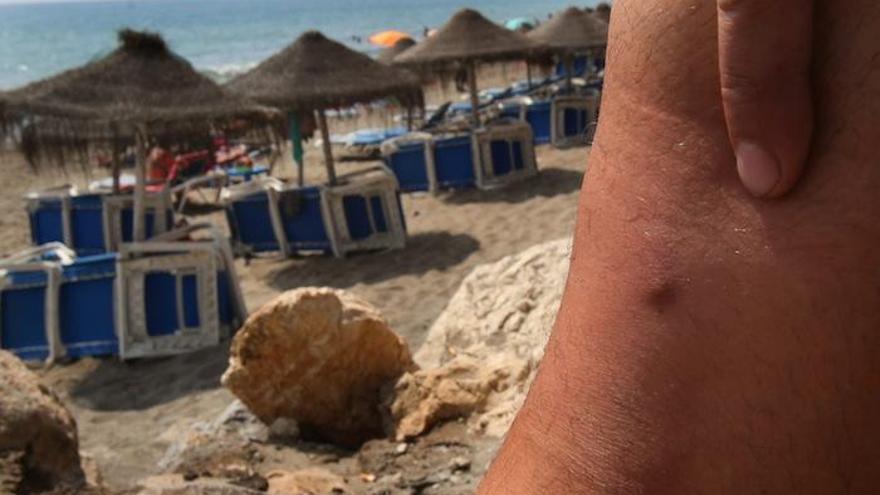 Un bañista muestra en la playa de La Misericordia una de sus picaduras.