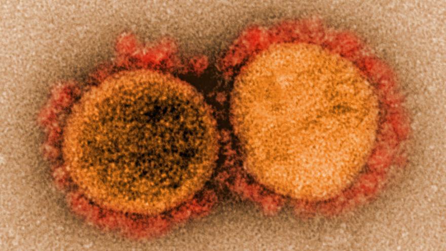 Los «secretos» de la variante Delta: es un «monstruo» al lado del coronavirus de Wuhan