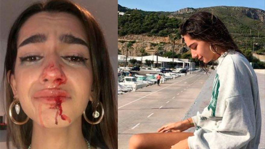 La joven agredida en una de sus fotos de Instagram