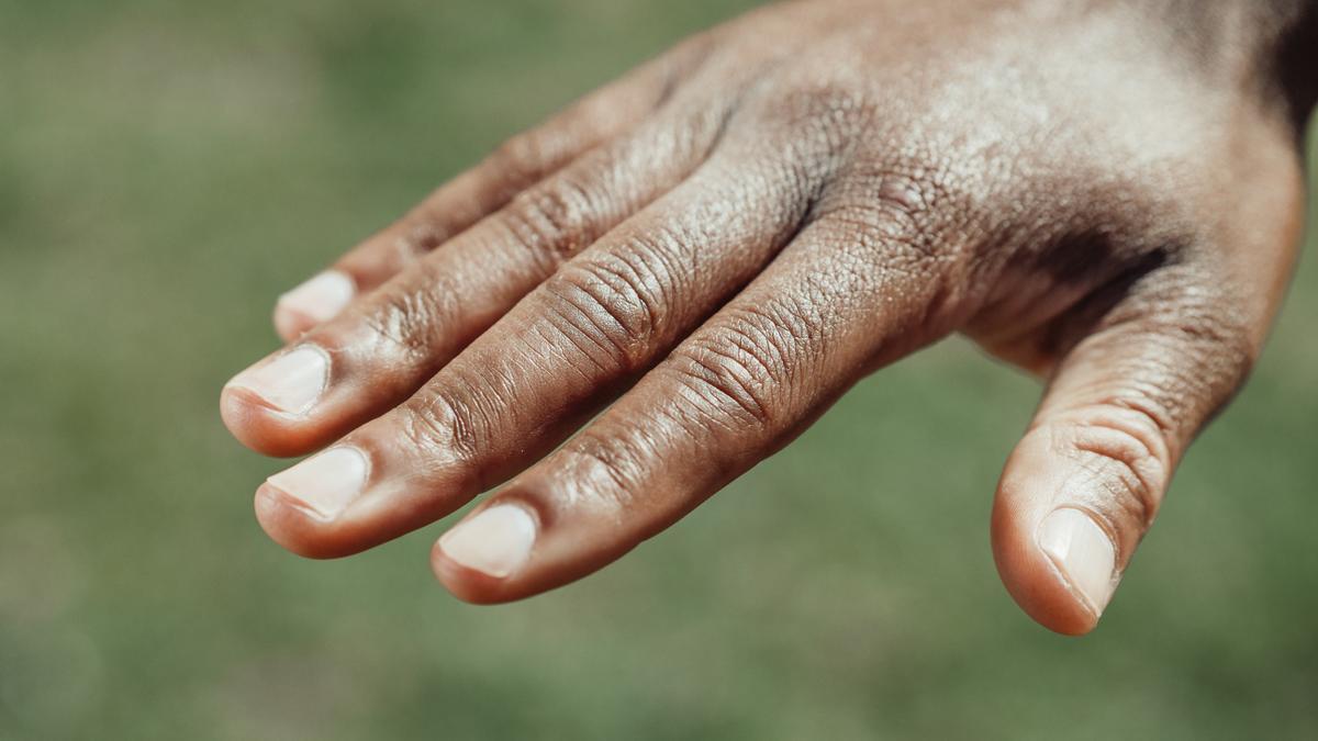 Las uñas pueden decir mucho de nuestro estado de salud.