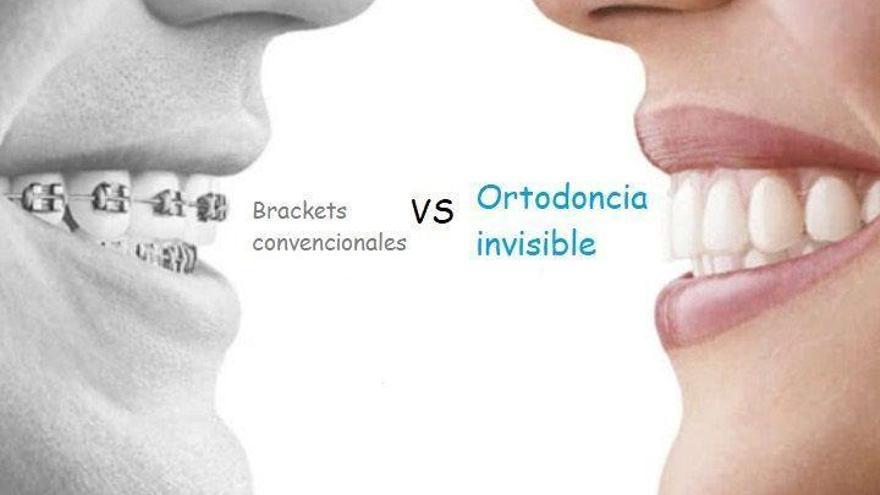 Jornada de Puertas Abiertas de ortodoncia invisible en la Clínica Robles
