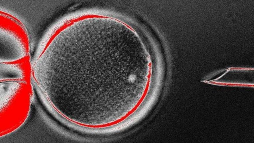 Imagen de la técnica de transferencia nuclear de células somáticas. / cell