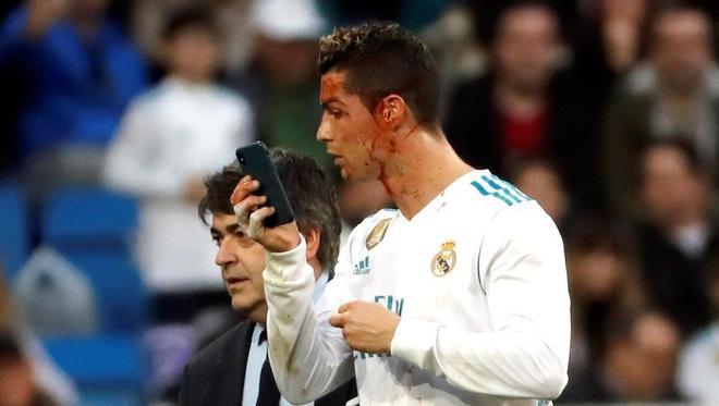 Cristiano Ronaldo se mira en el móvil para verse la herida