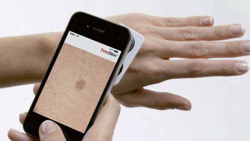 FotoSkin, app para la prevención y diagnóstico precoz del cáncer de piel