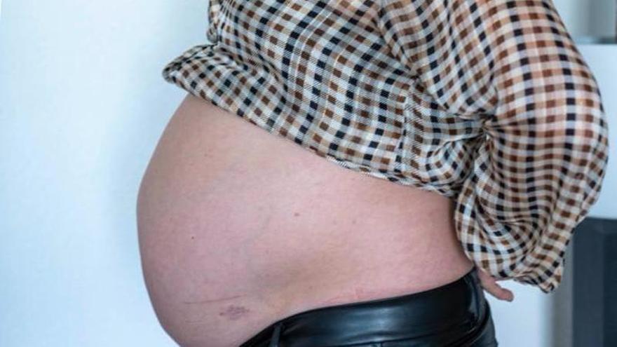 La zaragozana lleva una década esperando que el Salud la opere por una distensión abdominal similar a un embarazo de nueve meses.