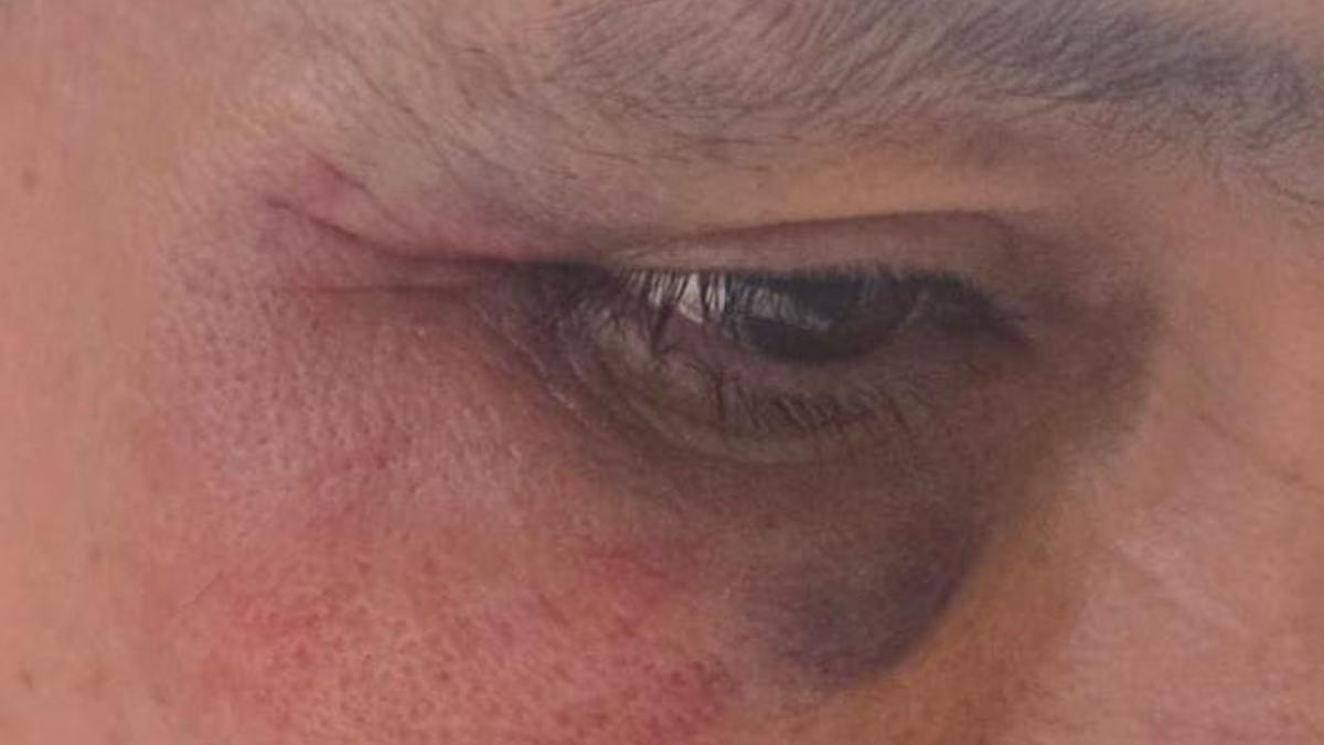 Uno de los vigilantes heridos en Valle Tabares