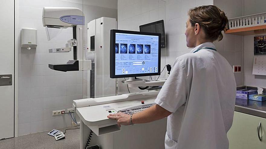Imatges d’una mamografia a l’Hospital d’Igualada | HUI