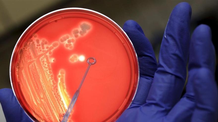 What are Klebsiella bacteria and how are they described?  5 keys