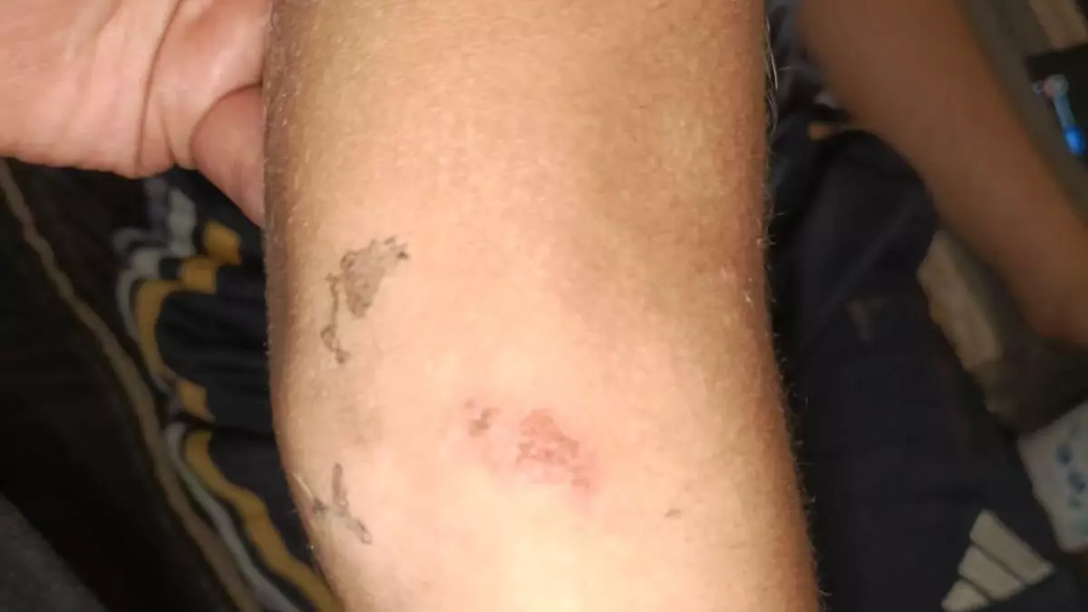 Denuncian a un concejal del PSOE de Albuquerque (Badajoz) por agredir a un menor de 8 años