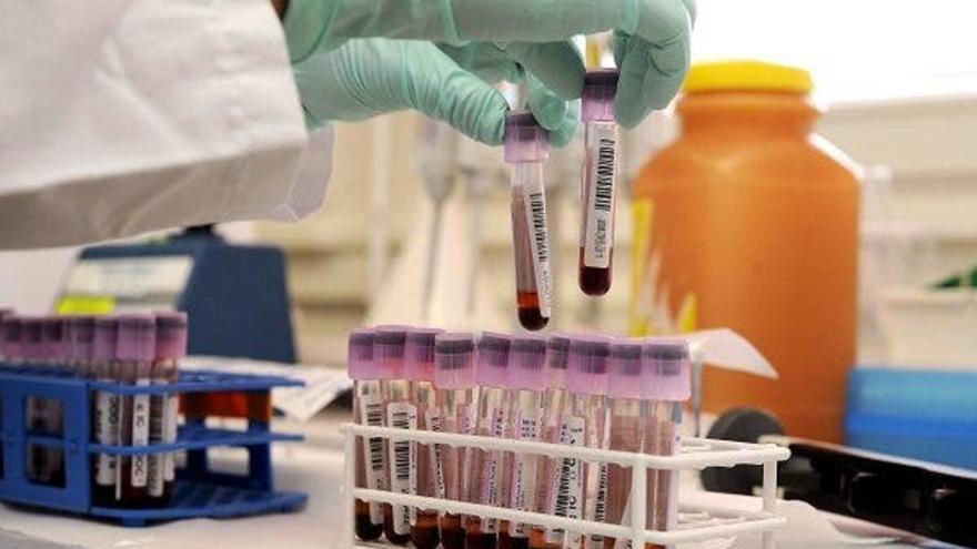 Cada 27 segundos se diagnostica un cáncer de sangre en el mundo: estos son los más frecuentes