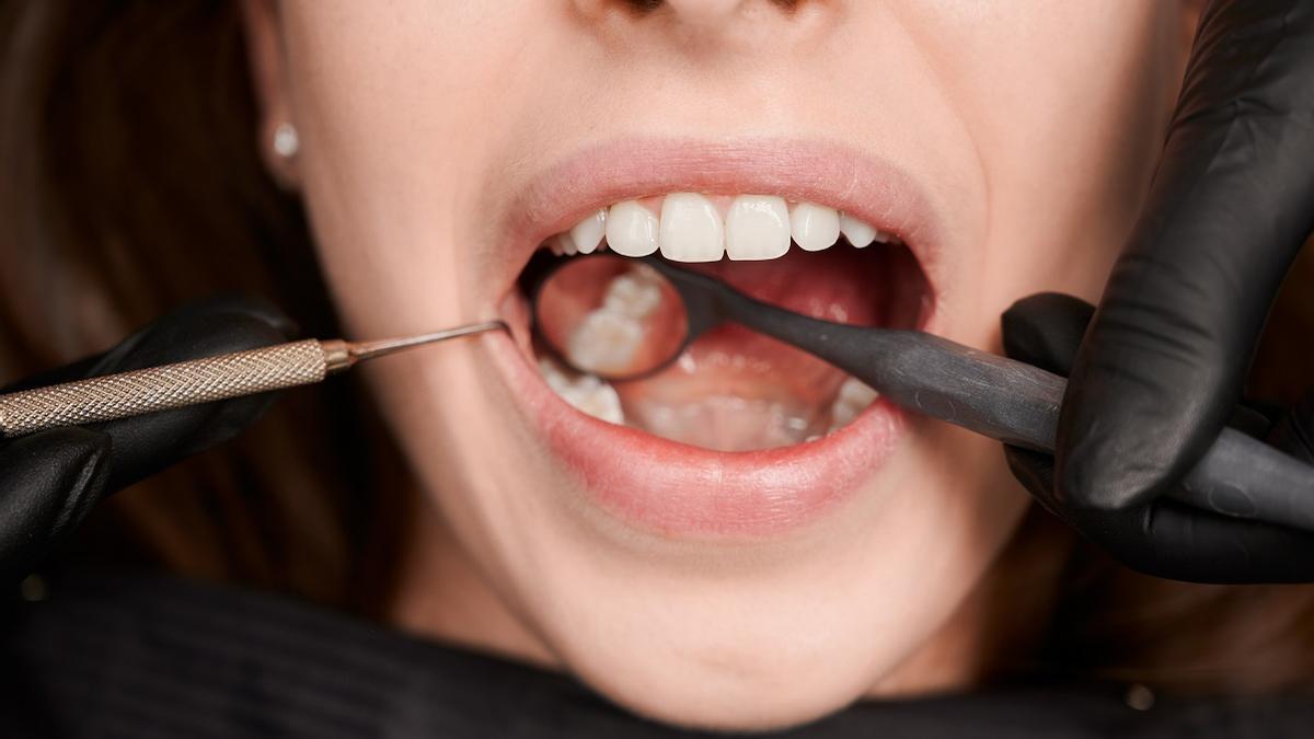 Caries, hongos o xerostomía son solo algunos de los problemas derivados de la alteración de los niveles de glucosa.