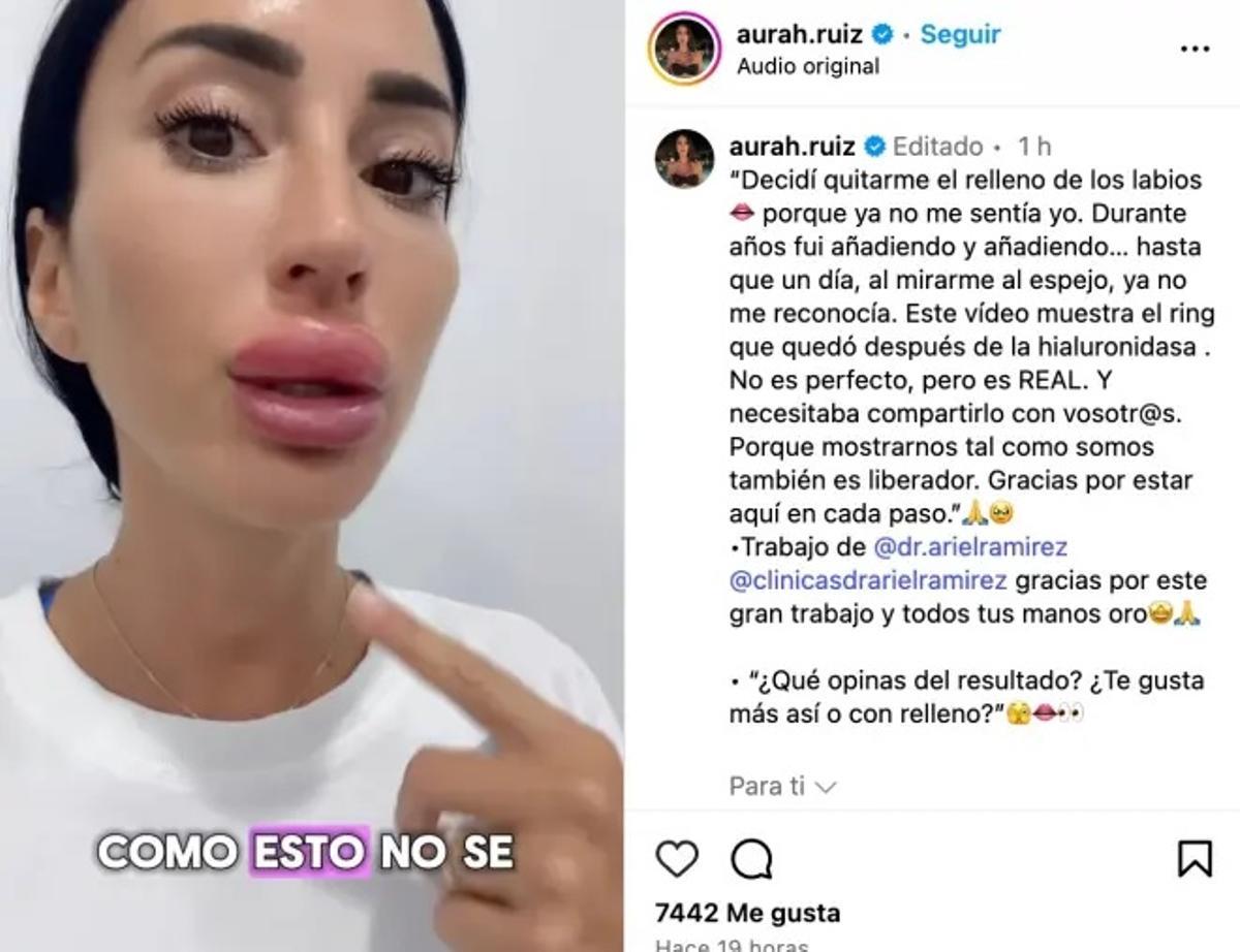 El comunicado de Aurah Ruiz