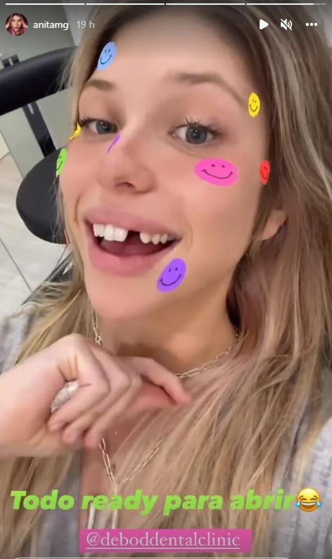 Anita Matamoros sin diente en Instagram