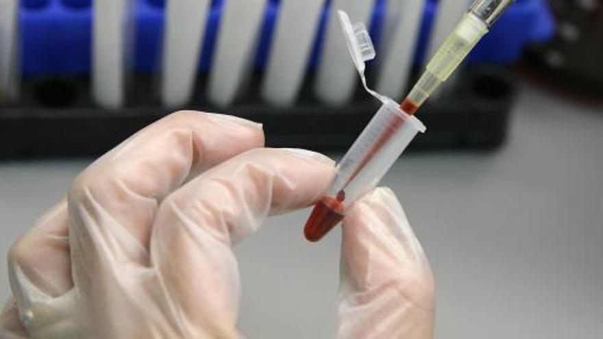 Un laboratorio analiza una muestra de sangre.