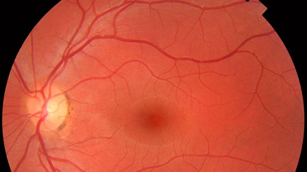 La IA se encargó en parte de identificar enfermedades en los escáneres de retina.