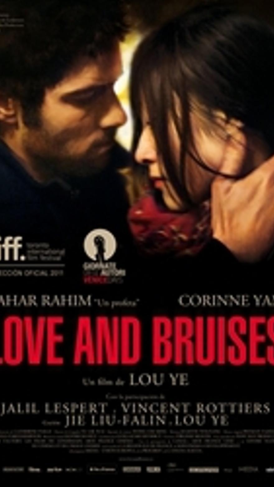 Love and bruises