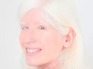 Patty Bonet: "Quiero optar a personajes a los que mi albinismo no los defina"