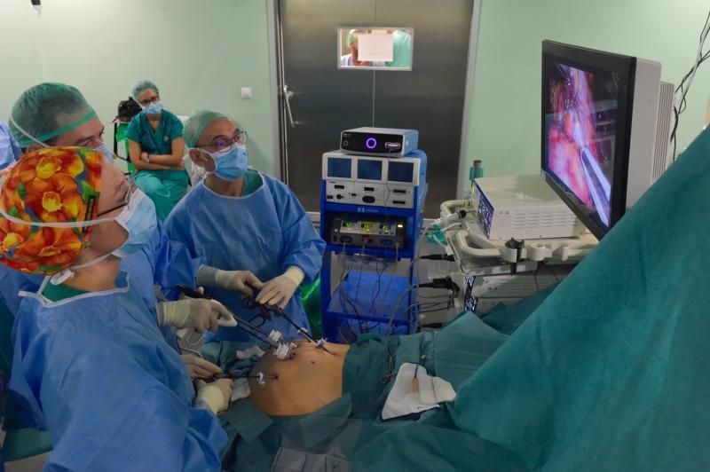 25-10-2018 LAS PALMAS DE GRAN CANARIA. Cirugía pancreática laparoscópica en el hospital Doctor Negrín. Fotógrafo: ANDRES CRUZ  | 25/10/2018 | Fotógrafo: Andrés Cruz