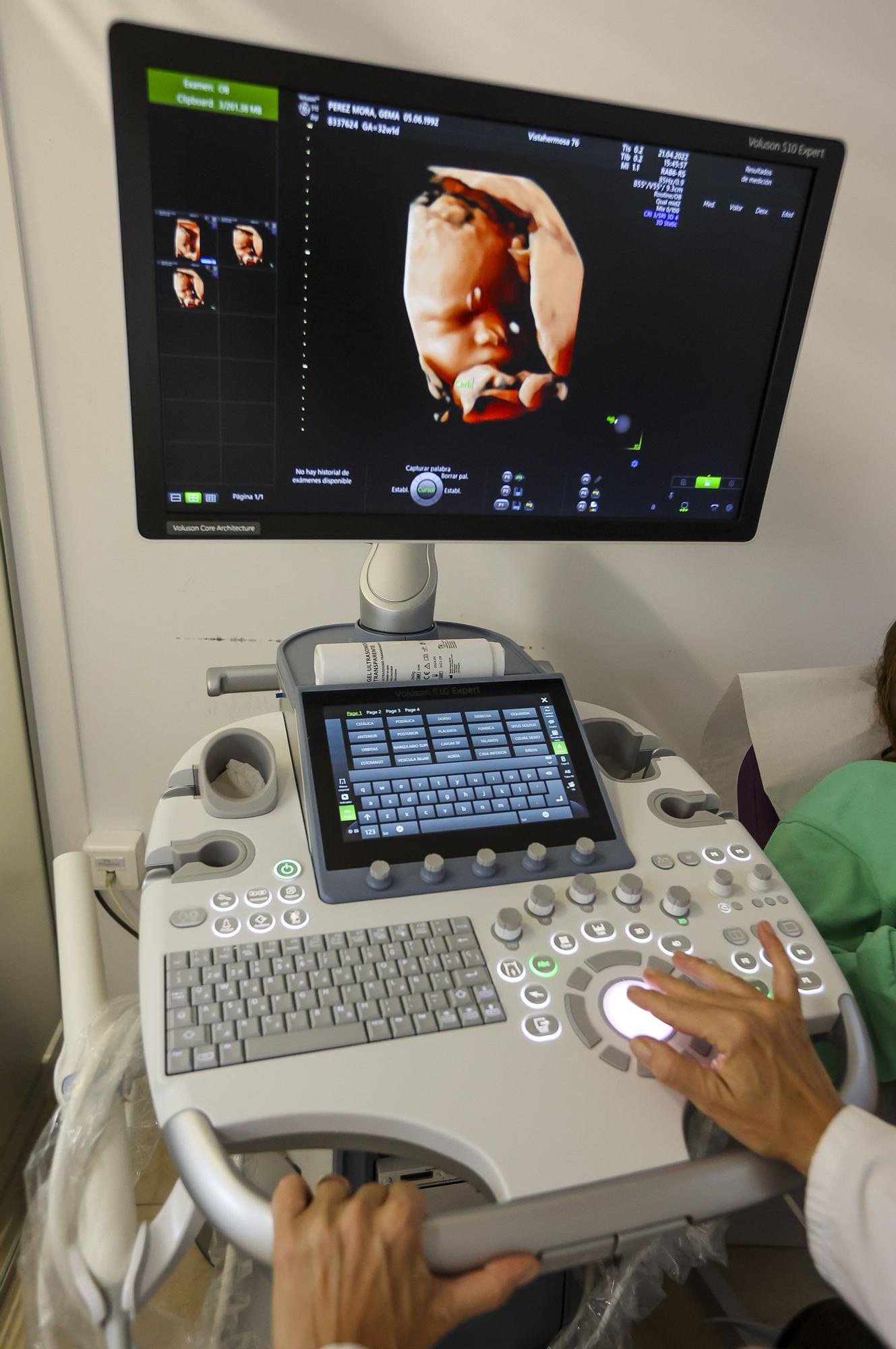 La Unidad de Diagnóstico Prenatal realiza multitud de pruebas que permiten comprobar alguna anomalía congénita en el feto