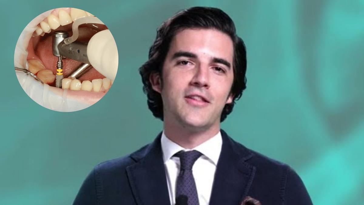 Javier Calatrava, odontólogo, sobre los implantes dentales