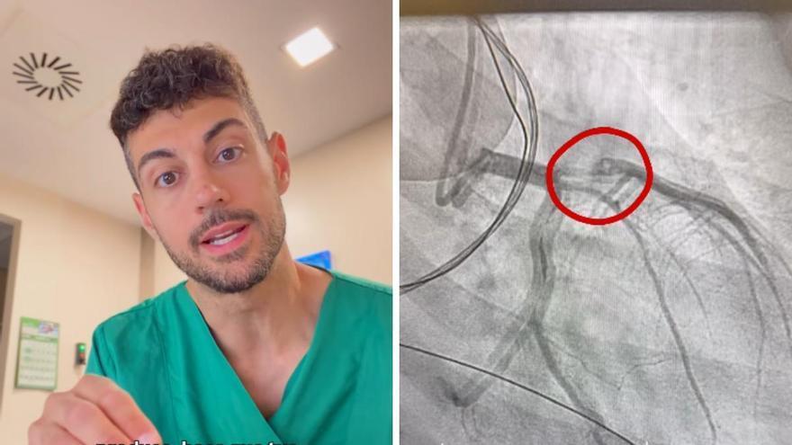 José Abellán descubre algo inesperado en el corazón de un paciente joven y lanza un aviso: 