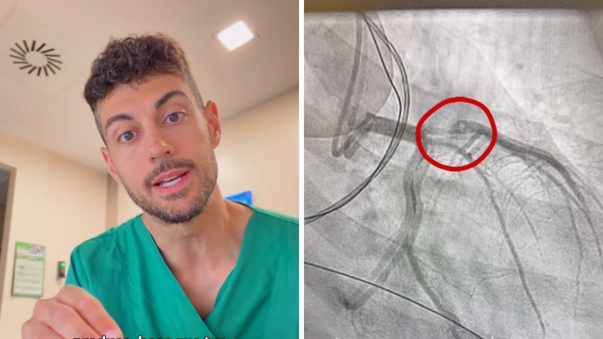 José Abellán descubre algo inesperado en el corazón de un paciente joven y lanza un aviso Os la jugáis