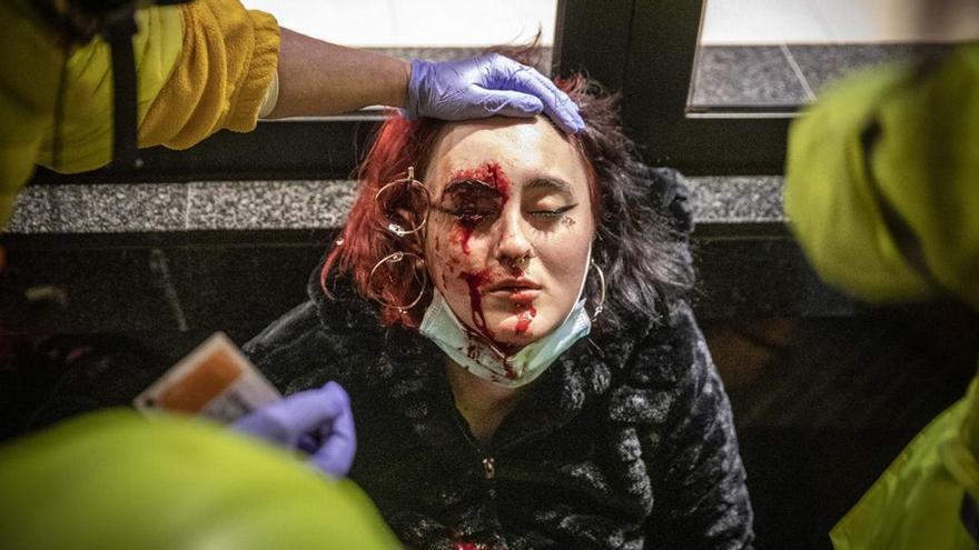 La jove que va perdre un ull en una manifestació en contra de l&#039;empresonament de Pablo Hasél