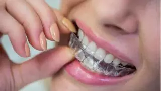 Saps com netejar la fèrula dental?