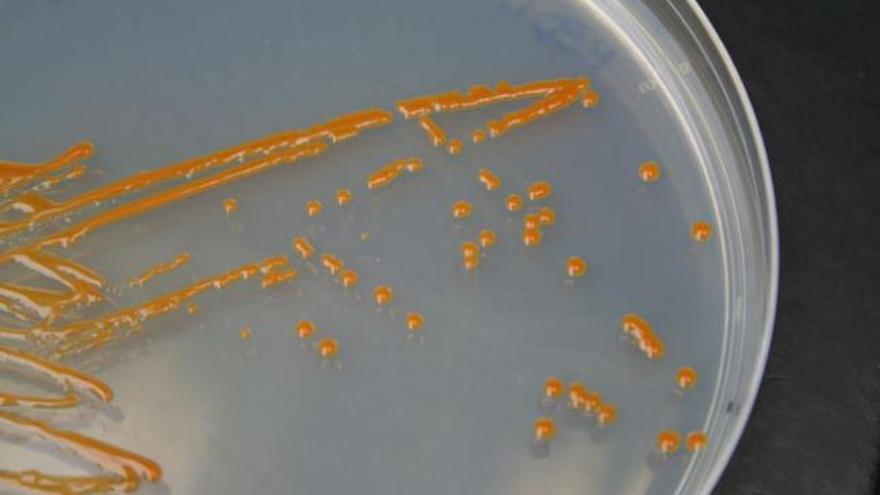 La bacteria &#039;Polaribacter&#039; en cultivo. | lp / dlp