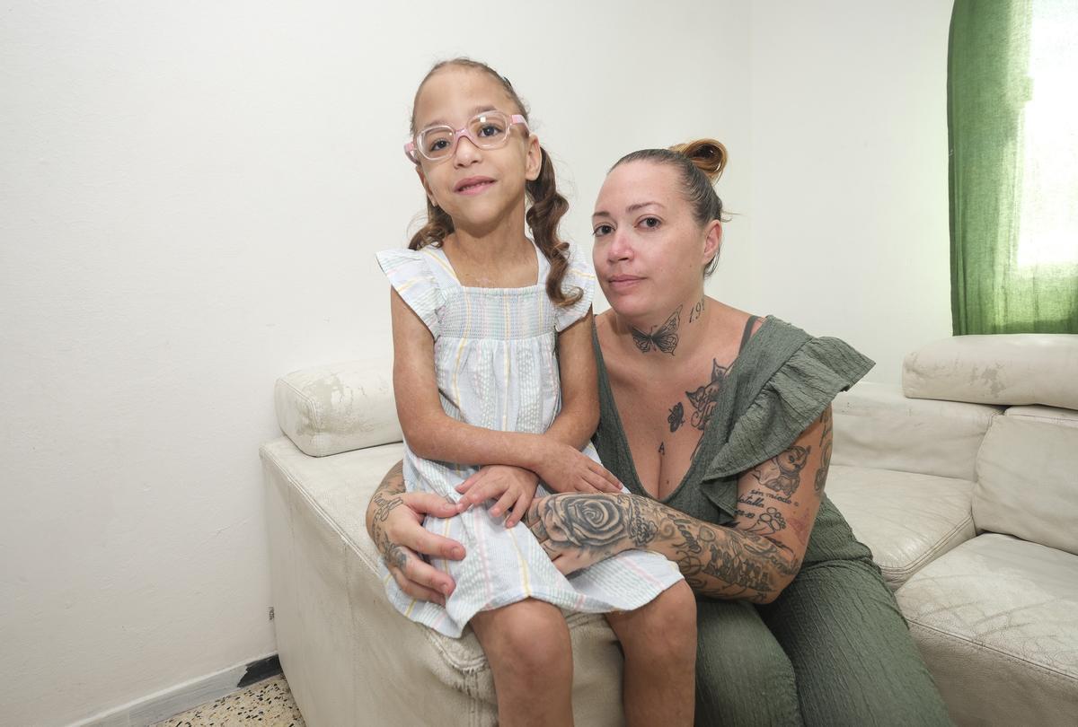 Briana Trujillo, la pequeña canaria con una enfermedad rara en la piel