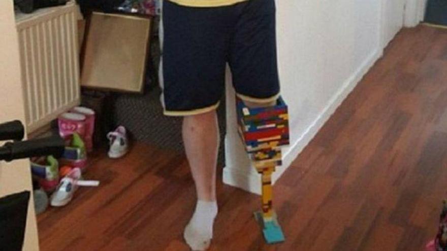 Una pierna ortopédica... de Lego