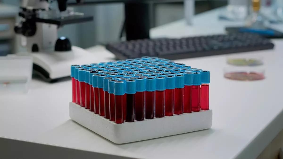 ¿Qué es la sangre dorada y por qué es una maldición para quien la posee?