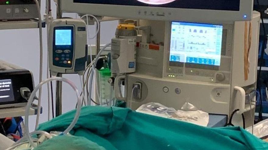 El hospital San Juan de Dios extirpa un tumor rectal con cirugía endoscópica