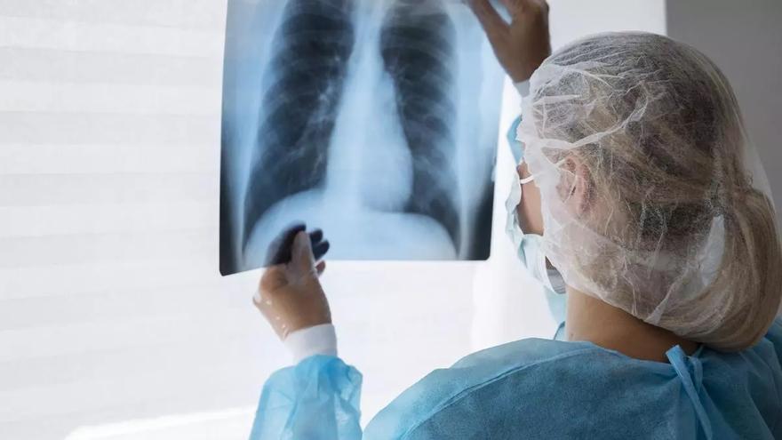 Brote de tuberculosis en Llanes: este es el siguiente paso que dará (este lunes) la Consejería de Salud