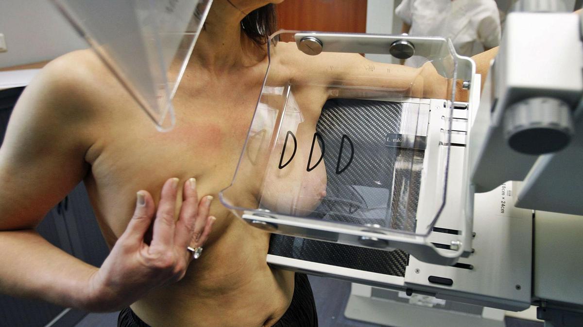 Una mujer realizándose una mamografía en Francia.