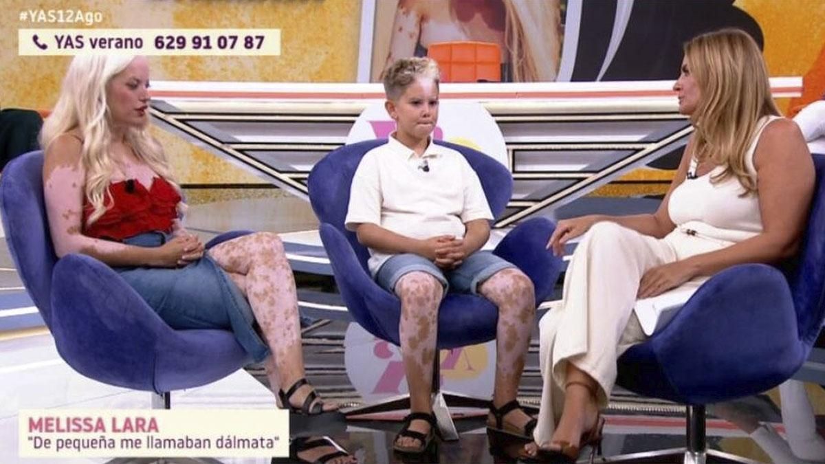 TELEVISIÓN | Pepa Romero pide disculpas en 'Yas verano' por un comentario a  unos invitados con piebaldismo