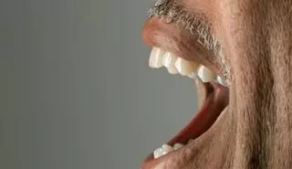 ¿Sabe tu boca a metal?