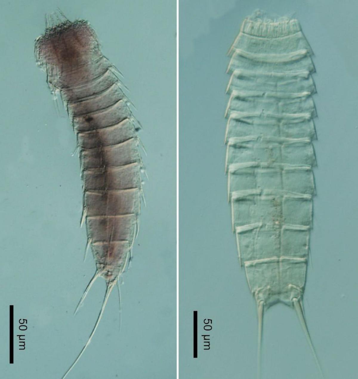 Dos ejemplares de Asturias donados al Museo de Ciencias Naturales: el de la izquierda es de la campaña de 1990 y el nombre de la especie es «Centroderes spinosus»; el ejemplar de la derecha es de la campaña de 2021 y el nombre de la especie es «Echinoderes worthingii». | Alberto González Casarrubios