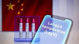 ¿Debemos preocuparnos por el nuevo brote de Henipavirus Langya? ¿Hemos entrado en la era de las pandemias?