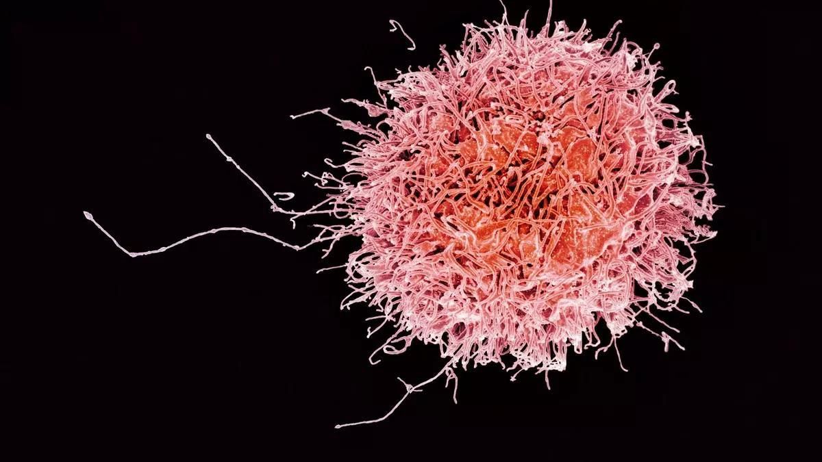 Imagen al microscopio de barrido de una célula NK o asesina.