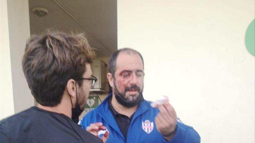 El entrenador del Vélez Juvenil, Francisco Rodríguez, tras ser agredido.