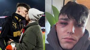 Pascal Kaiser, árbitro agredido tras pedir matrimonio a su pareja