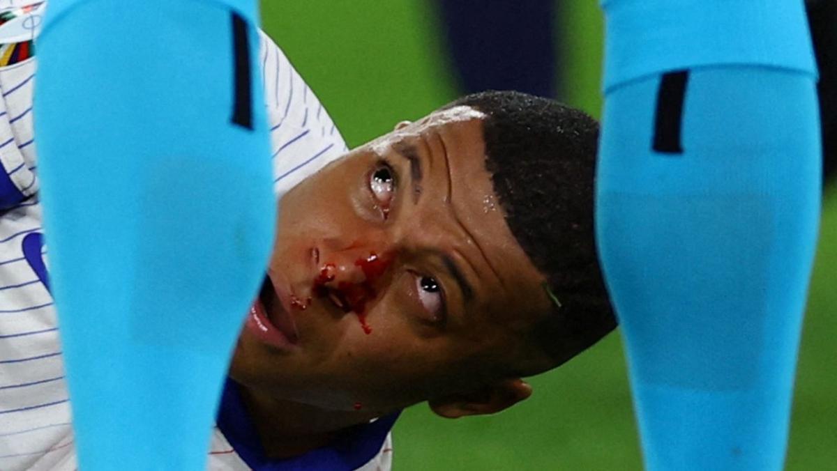 Mbappé, conmocionado y con la nariz desviada, yace a los pies de Gil Manzano.