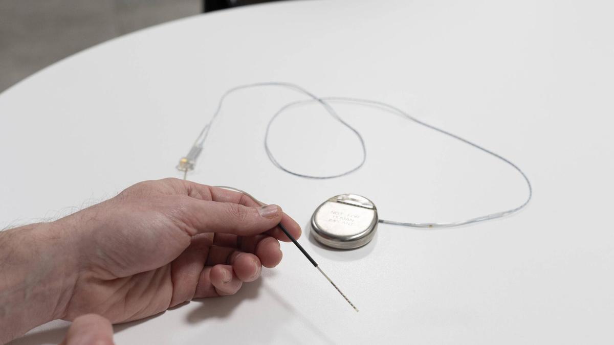 La Seguridad Social facilitará la jubilación anticipada a los enfermos de párkinson, espina bífida o con daños renales