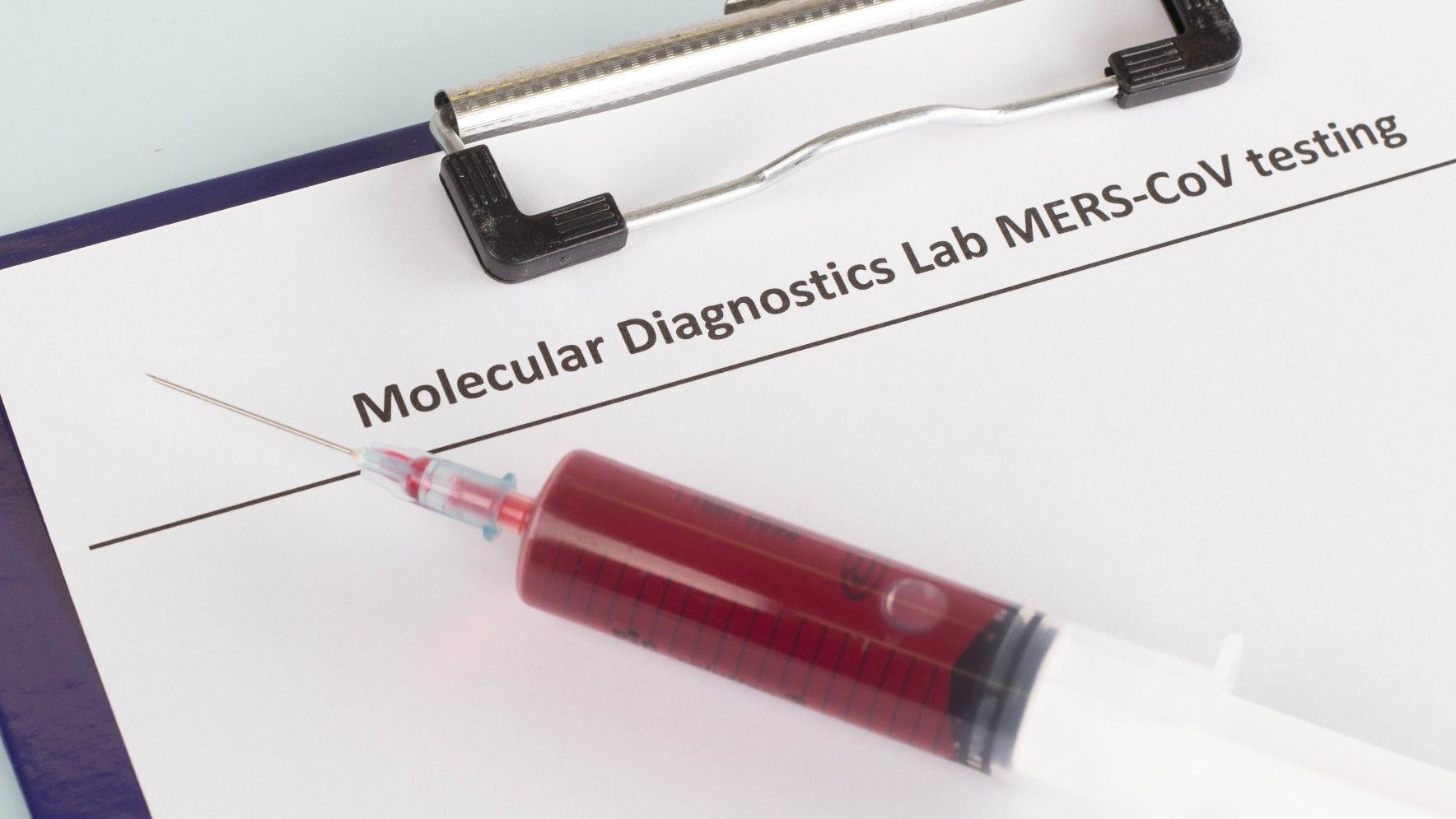 Una muestra para analizar la presencia de MERS.