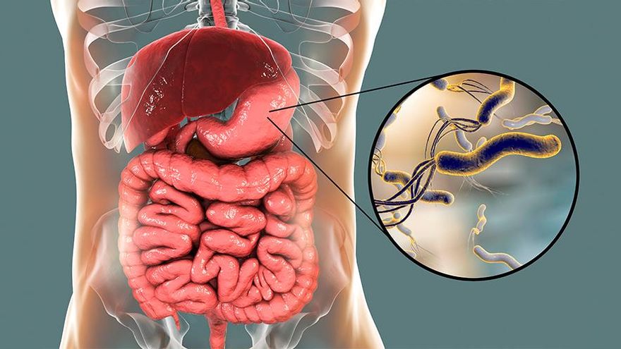 Así son los síntomas del Helicobacter pylori